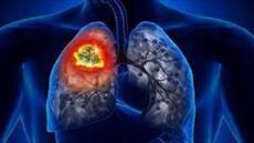 پاورپوینت COPD (انسداد ریه)